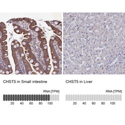 Carbohydrate Sulfotransferase 5/CHST5 Antibody, Novus Biologicals 0.1mL;